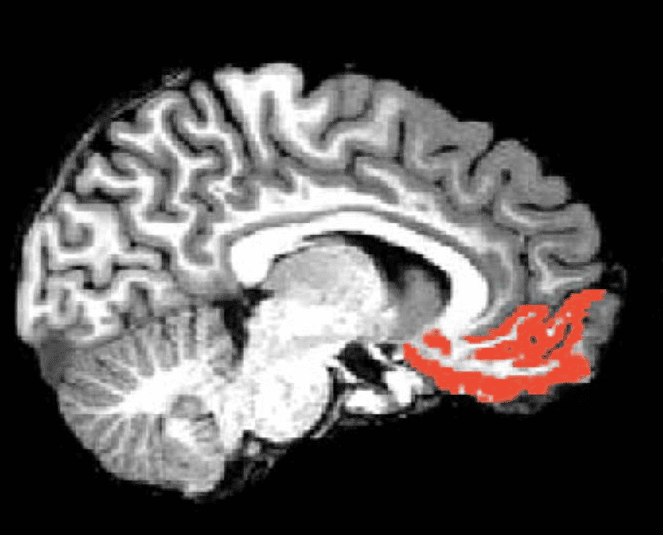 ventromedial prefrontal cortex